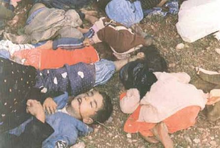 Saddam-Chmical-Victims-09.jpg