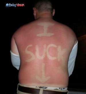 i_suck_sunburn.jpg