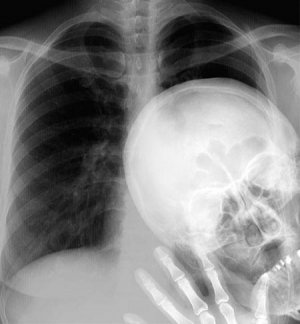 peak-a-boo-x-ray.jpg